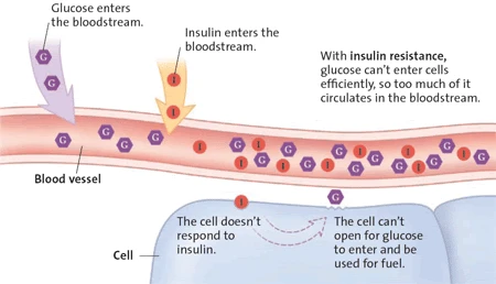 Type 2 Diabetes Diagram